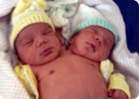 В Бразилии родился ребенок с двумя головами 